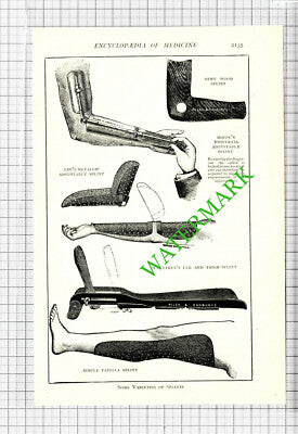 Varieties of Splints Hoppe Dupuytren Lee - Antique Medical Cutting - c.1915