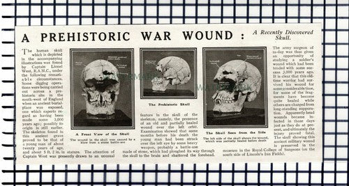 Capt Lionel West Prehistoric Skull Royal College Surgeons -  1918 Cutting