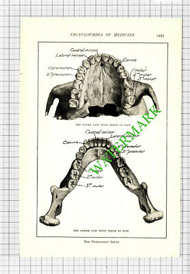 Human Teeth Diagram -  Antique Medical Cutting -  c.1915